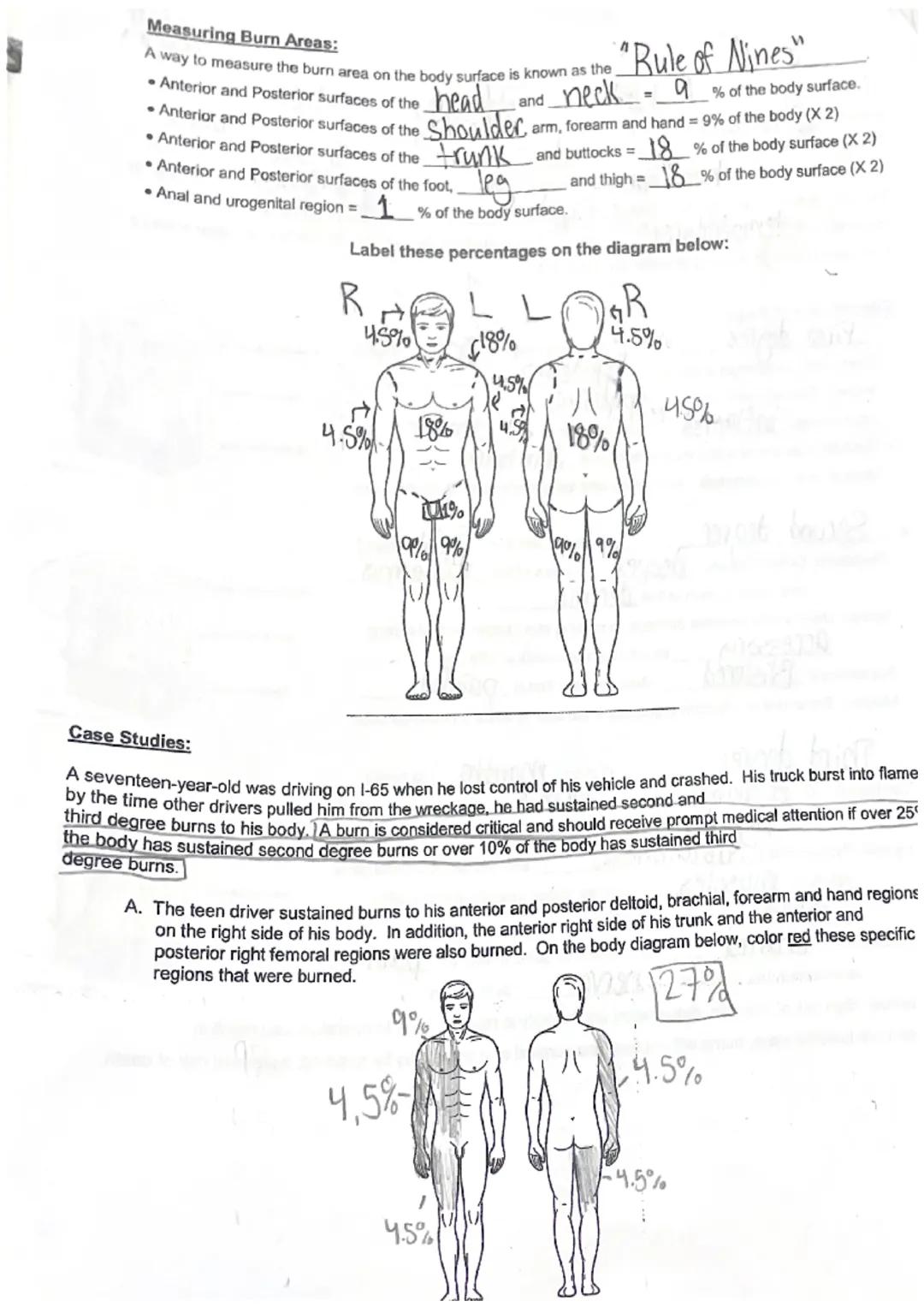 # Skin Burns
Tissue damage from excessive heat electricity radiation and/or
corrosive Chemicals that destroy exposed and underlying skin cel