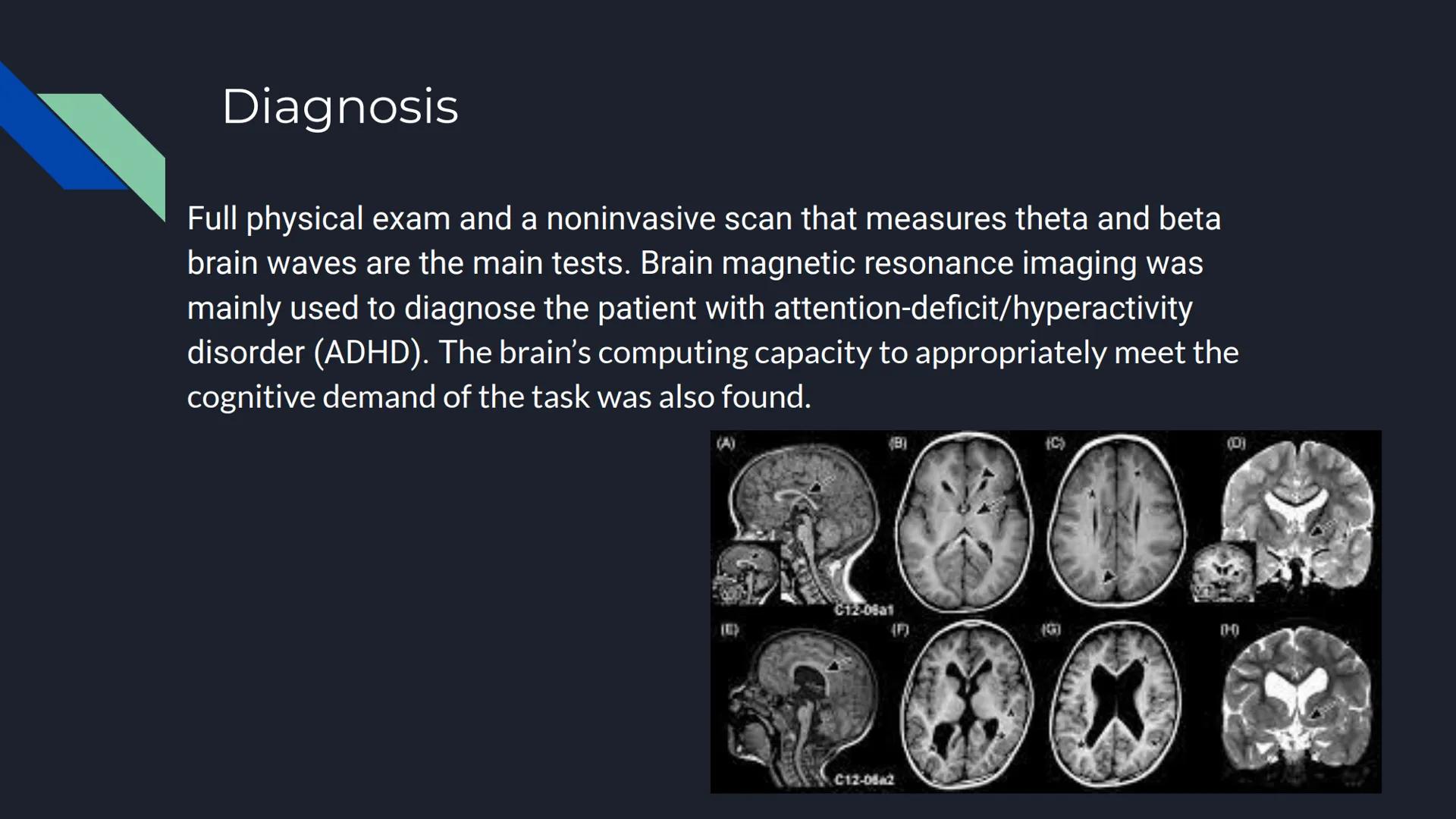 # Case Study on
ADHD

Chelsea Ngokwere # Patient's History

Name: Flora Crowder

Age: 19

Gender: Female

High

Low

Control Subject

ADHD S