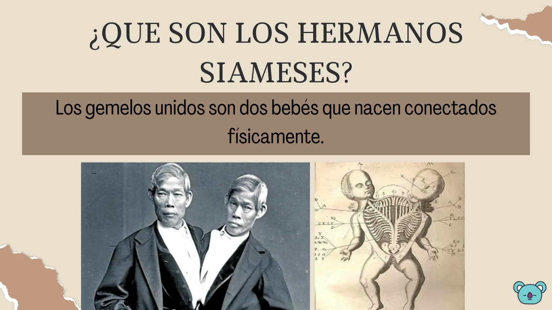 # HERMANOS

# SIAMESES

Septimo - 2022 # ¿QUE SON LOS HERMANOS
SIAMESES?

Los gemelos unidos son dos bebés que nacen conectados
físicamente.