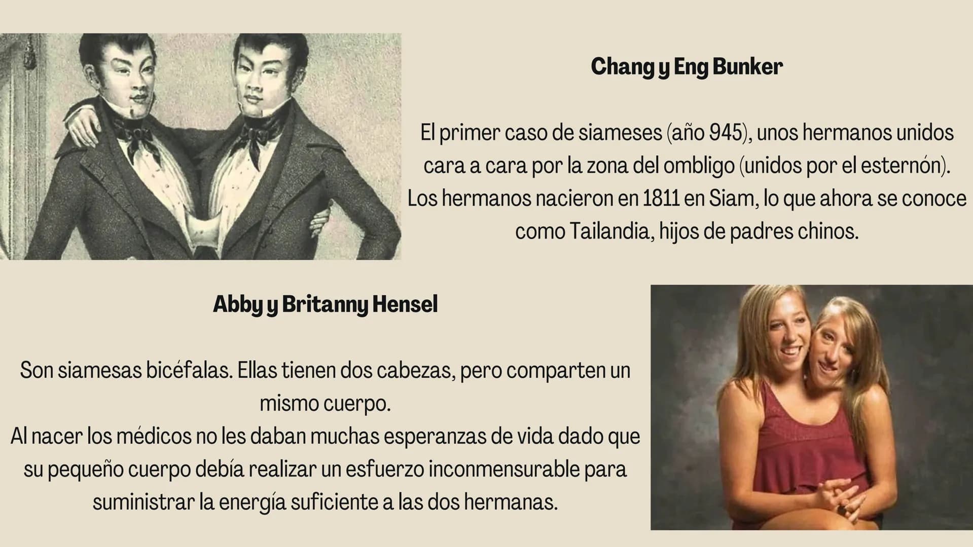 # HERMANOS

# SIAMESES

Septimo - 2022 # ¿QUE SON LOS HERMANOS
SIAMESES?

Los gemelos unidos son dos bebés que nacen conectados
físicamente.