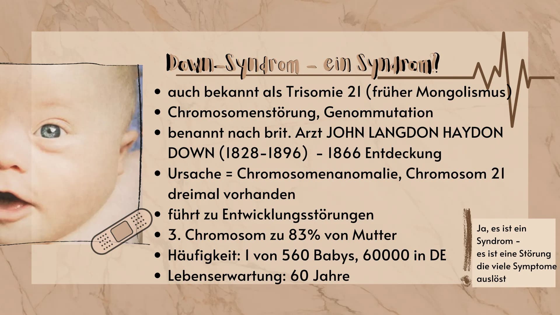 # Down-Syndrom

eine Erbkrankheit?

Präsentation
Sarah Keller
13.01.2021
BIO LK Gliederung

Was ist ein Syndrom?
Down-Syndrom- Ein Syndrom?
