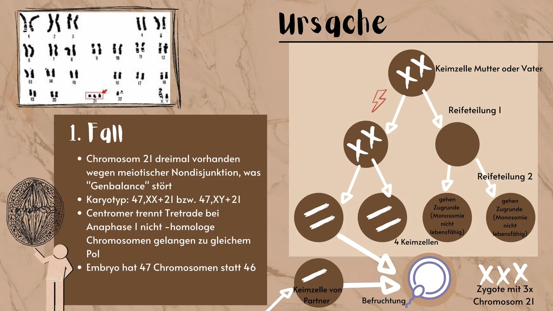 # Down-Syndrom

eine Erbkrankheit?

Präsentation
Sarah Keller
13.01.2021
BIO LK Gliederung

Was ist ein Syndrom?
Down-Syndrom- Ein Syndrom?
