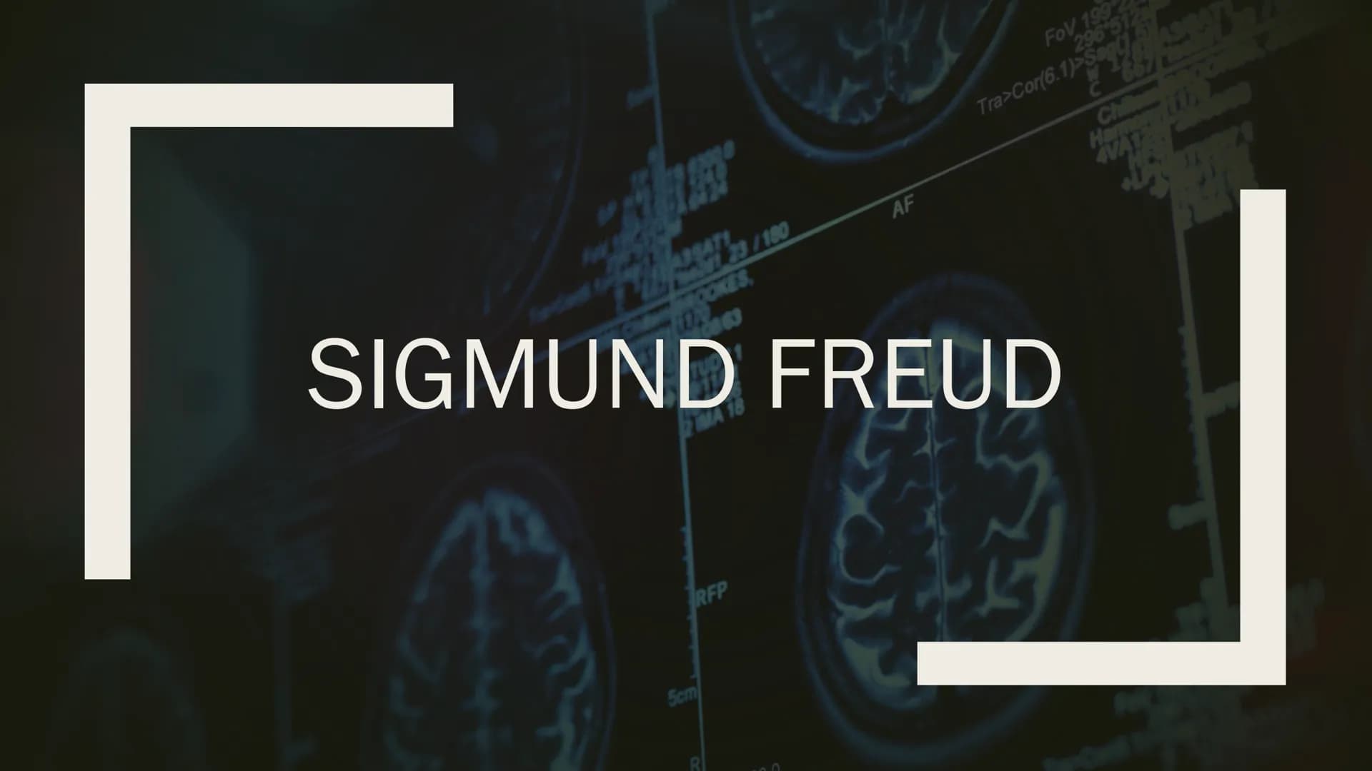 FoV 199
296 5128
Tra>Cor(6.1)>Sag(15
1248
C667
Chille
4VA12
43SAT1
1621 23/180
OOKES,
AF
SIGMUND FREUD
IMA 18
5cm
R
RFP
0 # Wer war Sigmund 