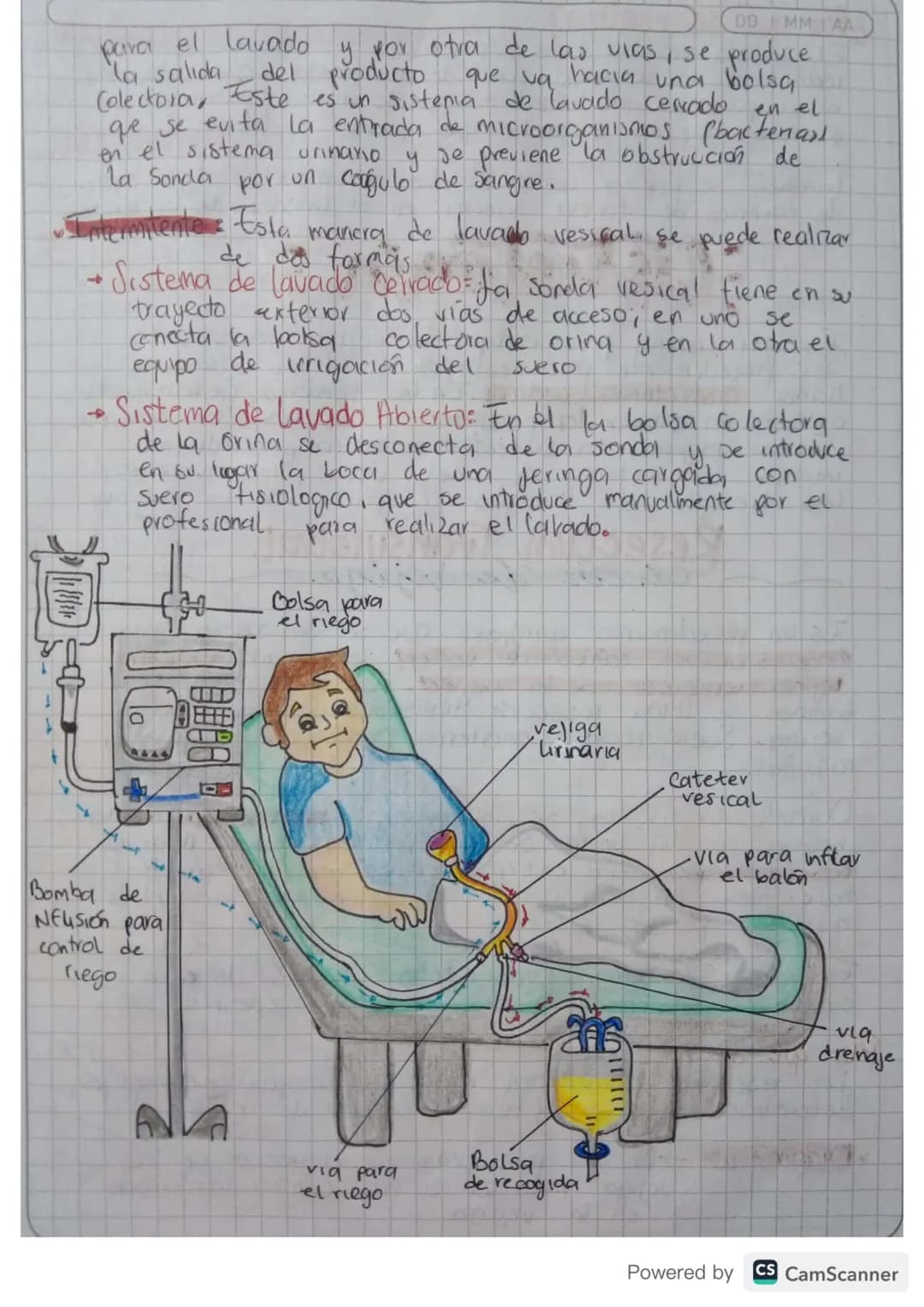 # Cisto trigación

LAVADO VESICAL

*   to una tecnica de tratamiento en la que se anticduce
la vejiga del paciente, frecuentemente suer
flex