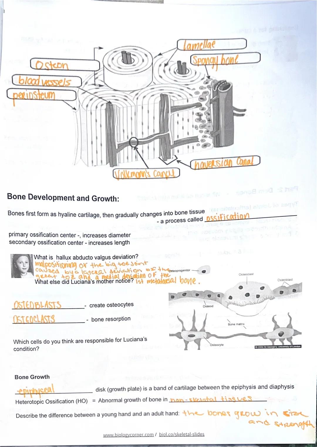 Kailyn Scott
SKELETAL SYSTEM Google Slides

Case: Luciana

Describe Fibrodysplasia Ossificans Progressiva (FOP)

FUNCTIONS - support and pro