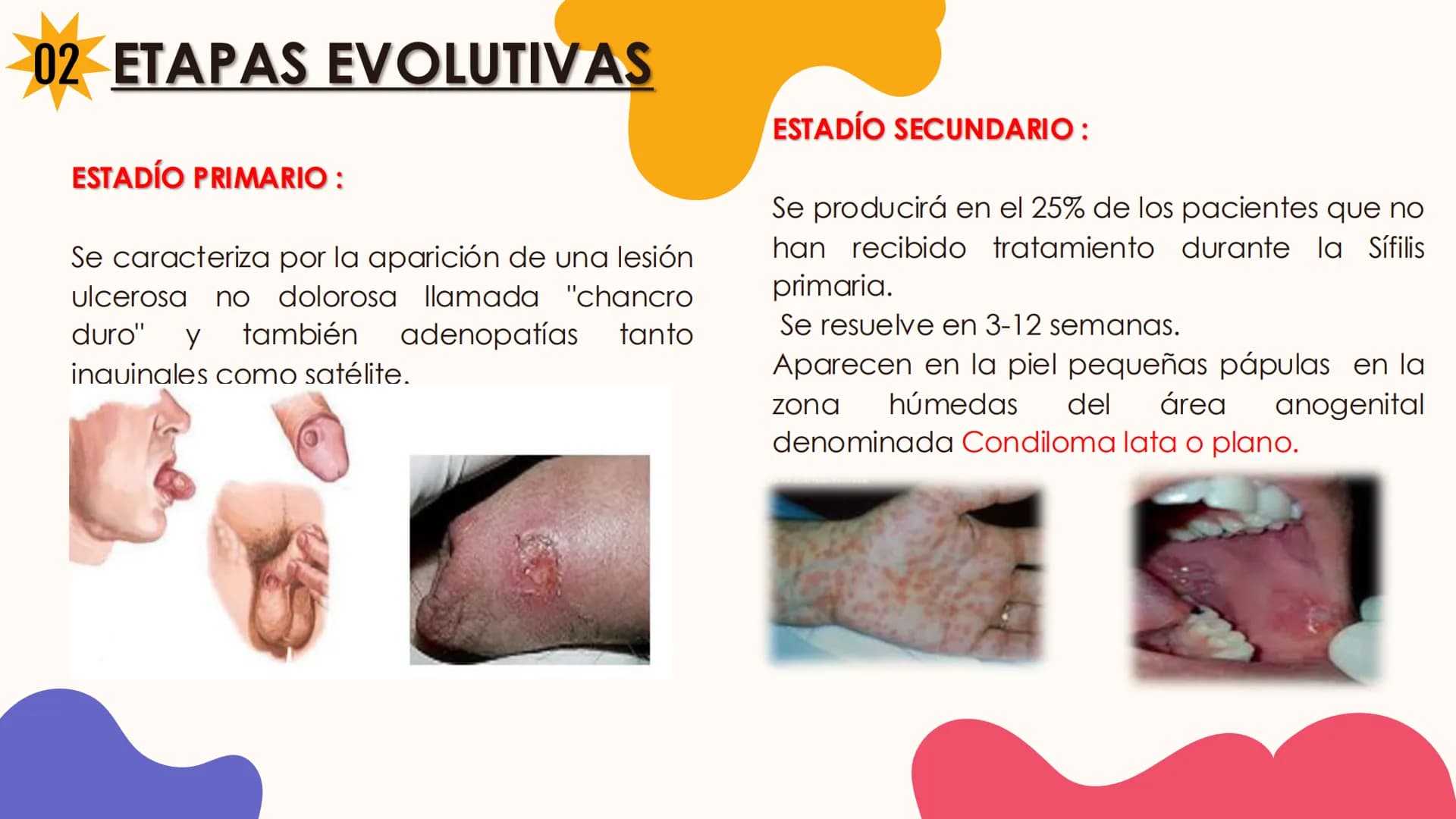 # Enfermedad de transmisión sexual
Sifilis INTEGRANTES
Sarmiento Mendoza josué
Flores Arenas Victor Manuel
Castro Martínez Renato
Domingue
