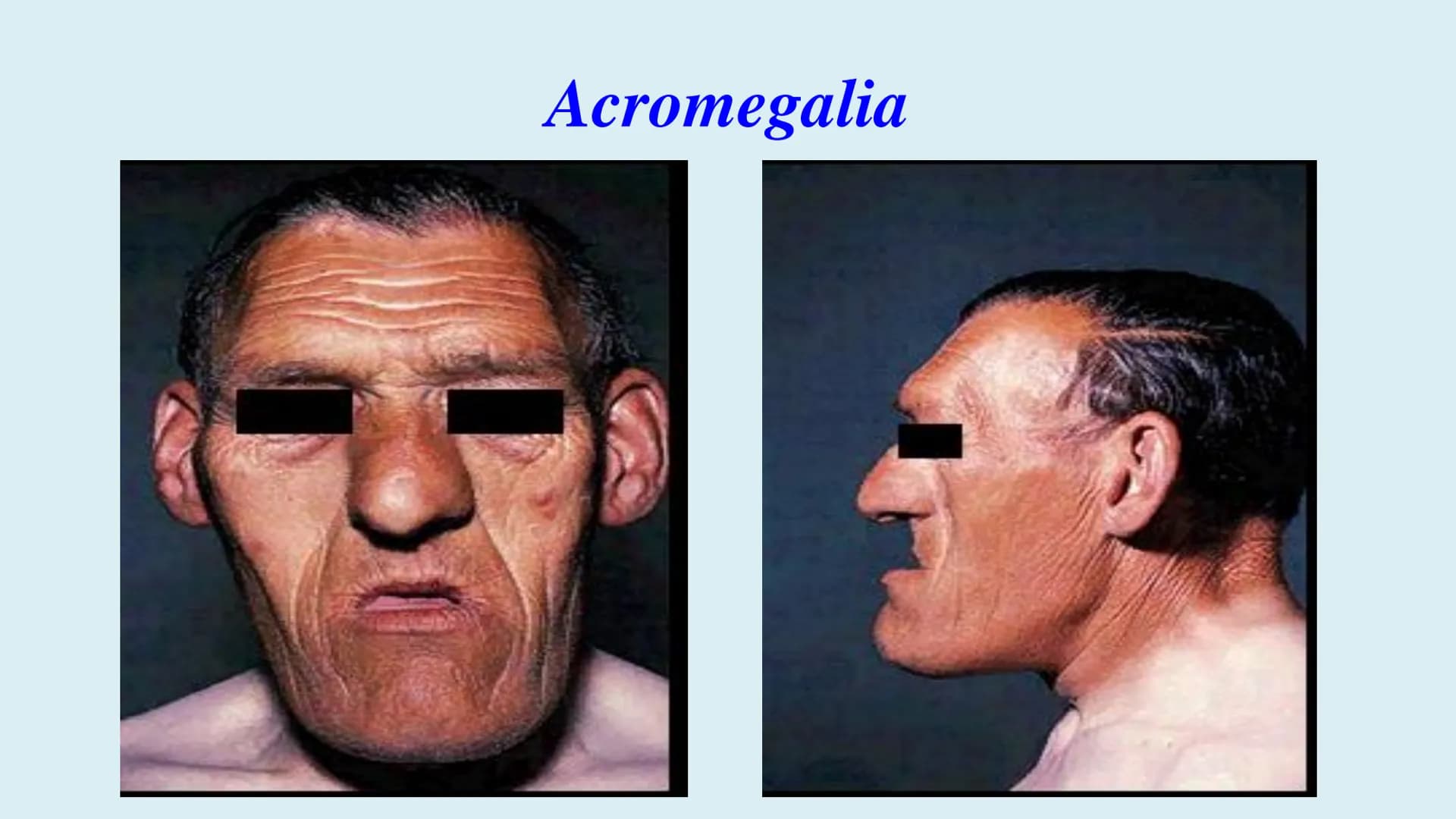 # BACALAUREAT
ANATOMIE ȘI FIZIOLOGIE UMANĂ
SISTEMUL ENDOCRIN # Sistemul endocrin
• Sistemul endocrin reprezintă
totalitatea glandelor end