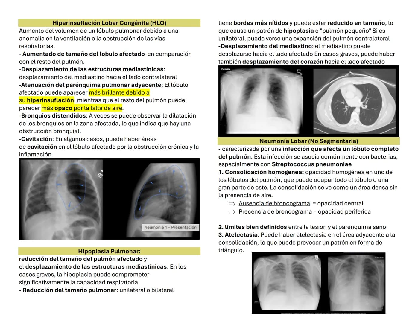 NEUMONIA 1 OBJETIVOS
Pectus excavatum
genera una concavidad en la parte anterior del tórax. (Torax en
embudo hace referencia la forma que ge