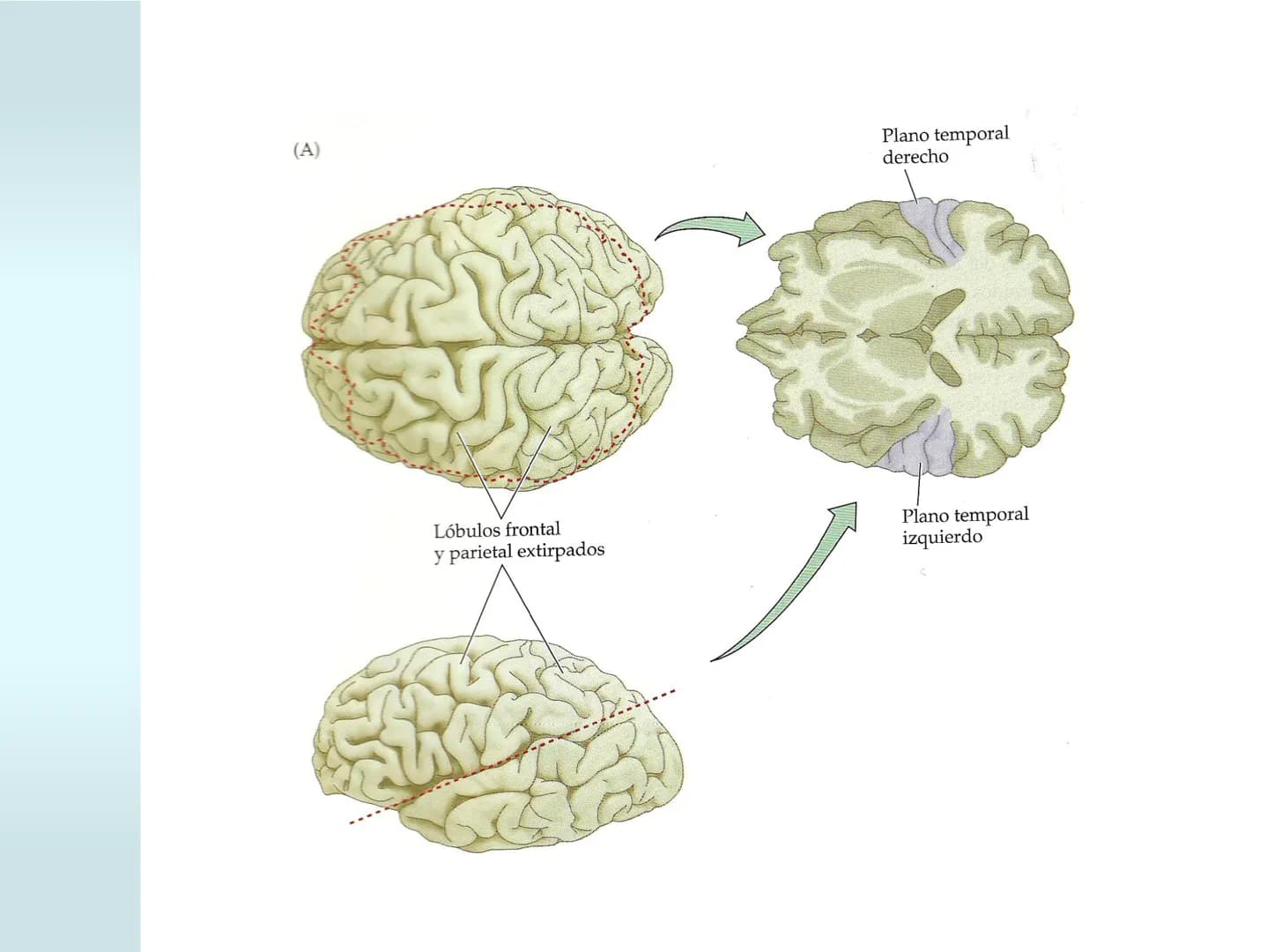 # NEUROPSICOLOGIA DEL
LENGUAJE
ADRIANA M. MARTINEZ
Máster en Rehabilitación Neuropsicológica y
Estimulación Cognitiva- UAB Definición
? -
