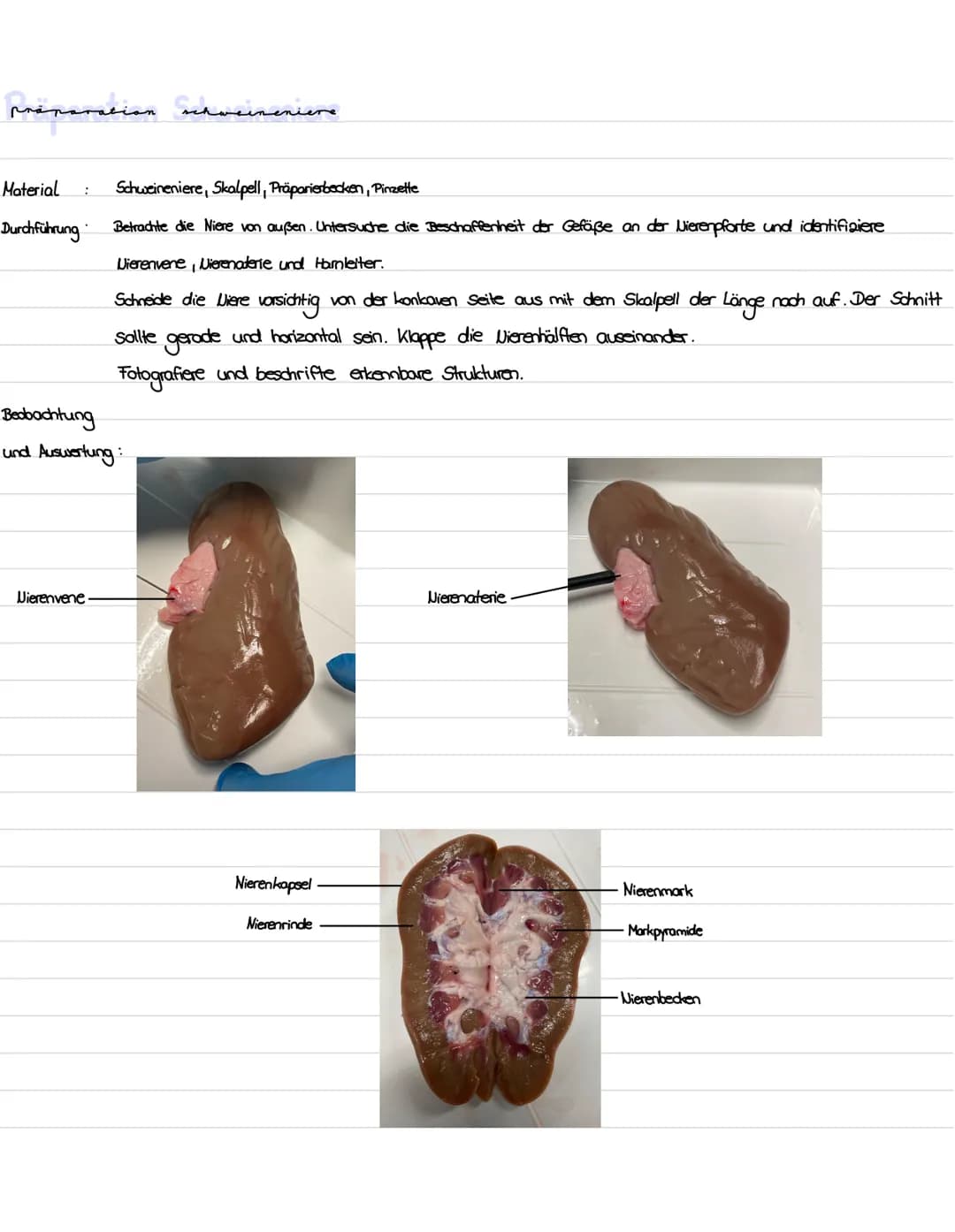 # Die Niere Gliederuns
1. Präparation Niere
2. Aufbau und Lage der Niere
3. Funktion der Niere
4. Bau, Funktion und Lage des Nephrons
5