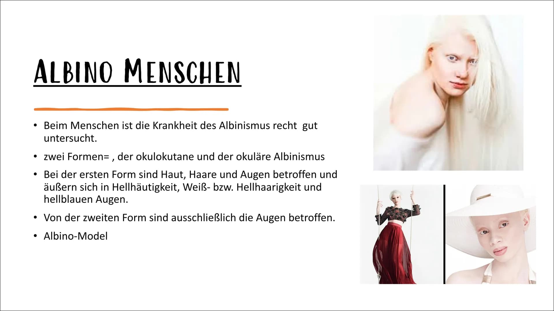 # ALBINISMUS
VON IPEK UND LABINA AGENDA:
Was ist Albinismus?
Albino Menschen
Albino Tiere
Familienbaumstamm der Albinus
Symptome und B