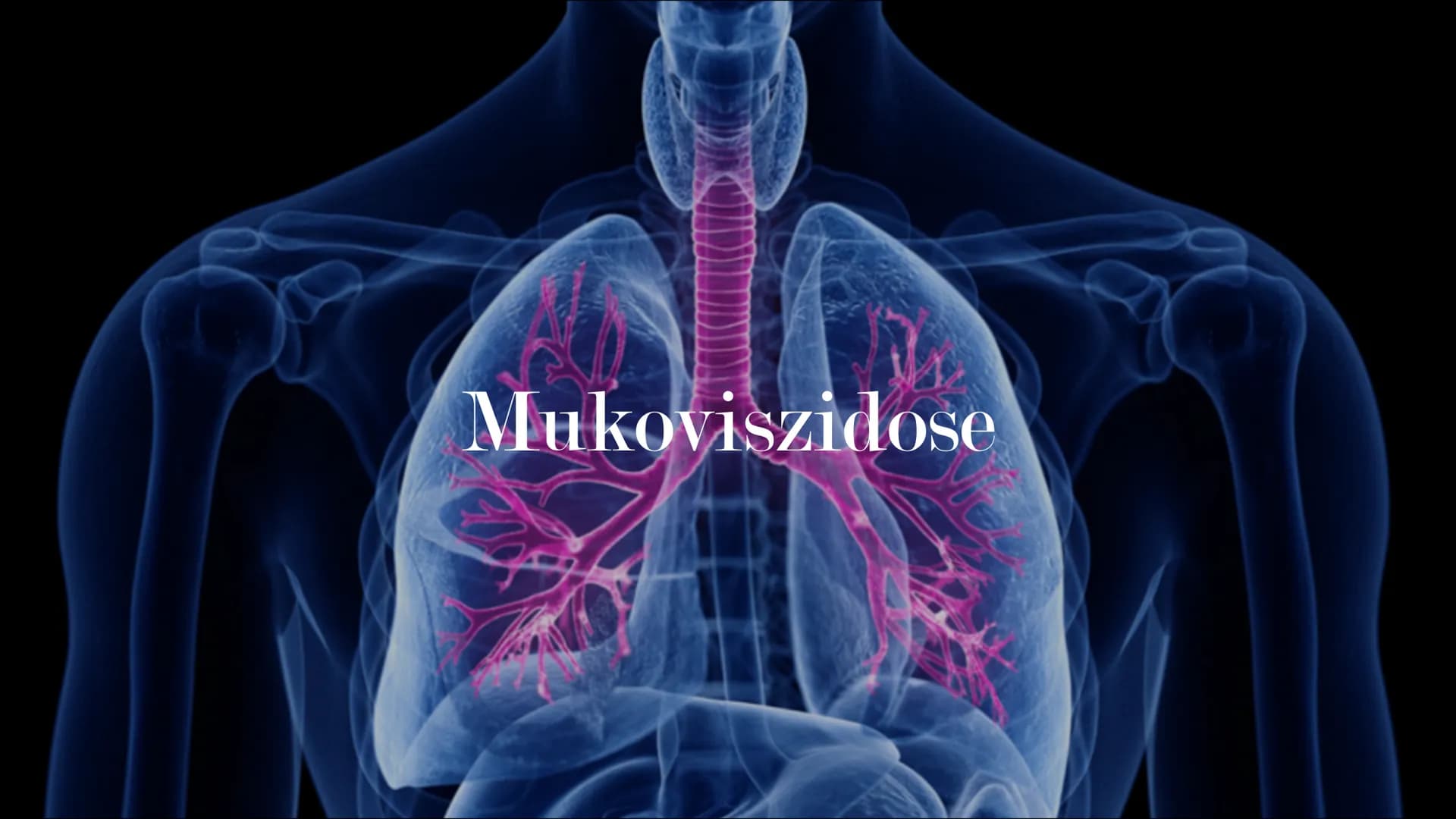 Mukoviszidose # Inhalt
• Was ist Mukoviszidose?
• Ursachen
• Genetische Vererbung
• Symptome
• Diagnoseverfahren
• Behandlungsmöglichkeiten
