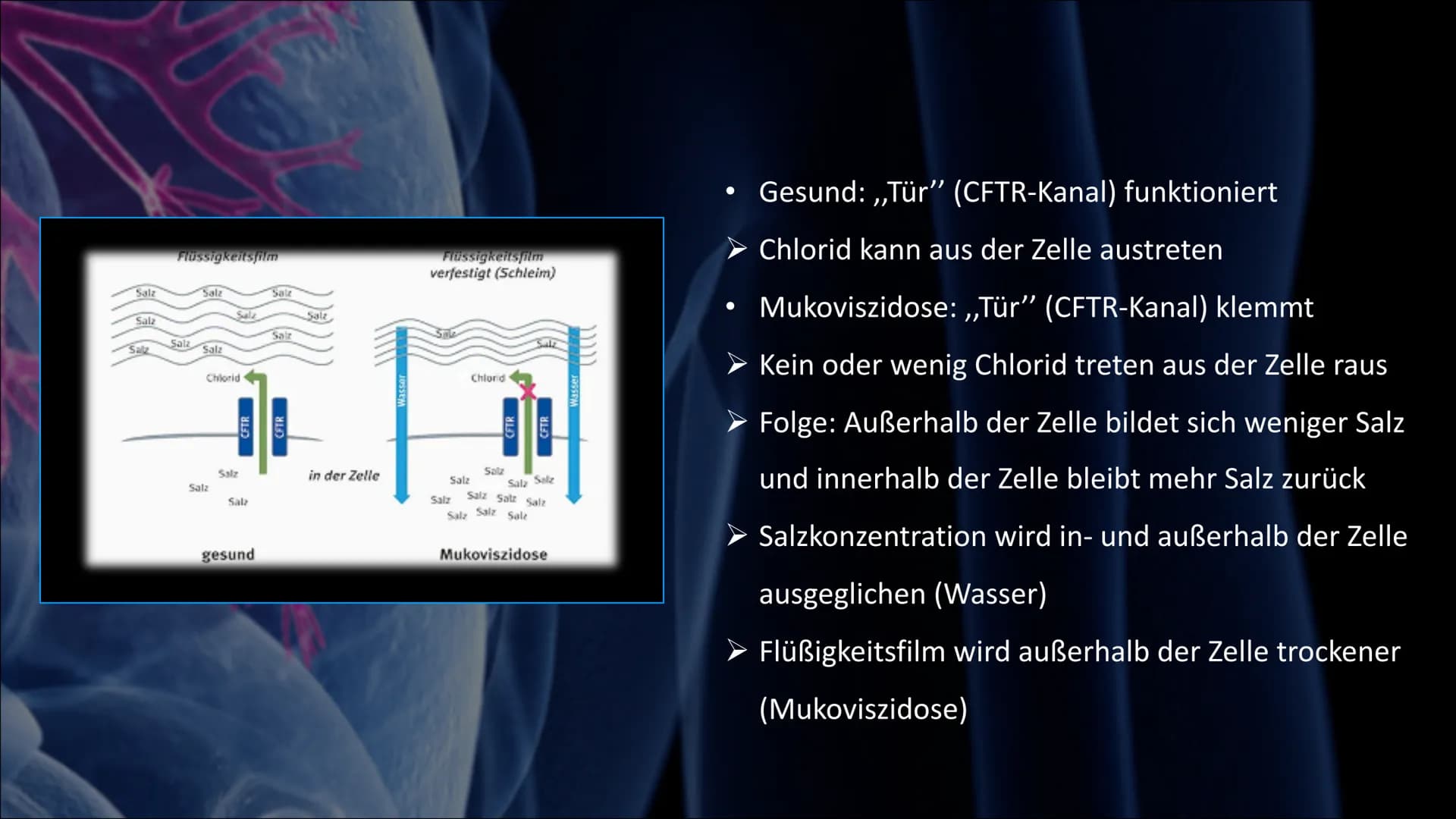 Mukoviszidose # Inhalt
• Was ist Mukoviszidose?
• Ursachen
• Genetische Vererbung
• Symptome
• Diagnoseverfahren
• Behandlungsmöglichkeiten