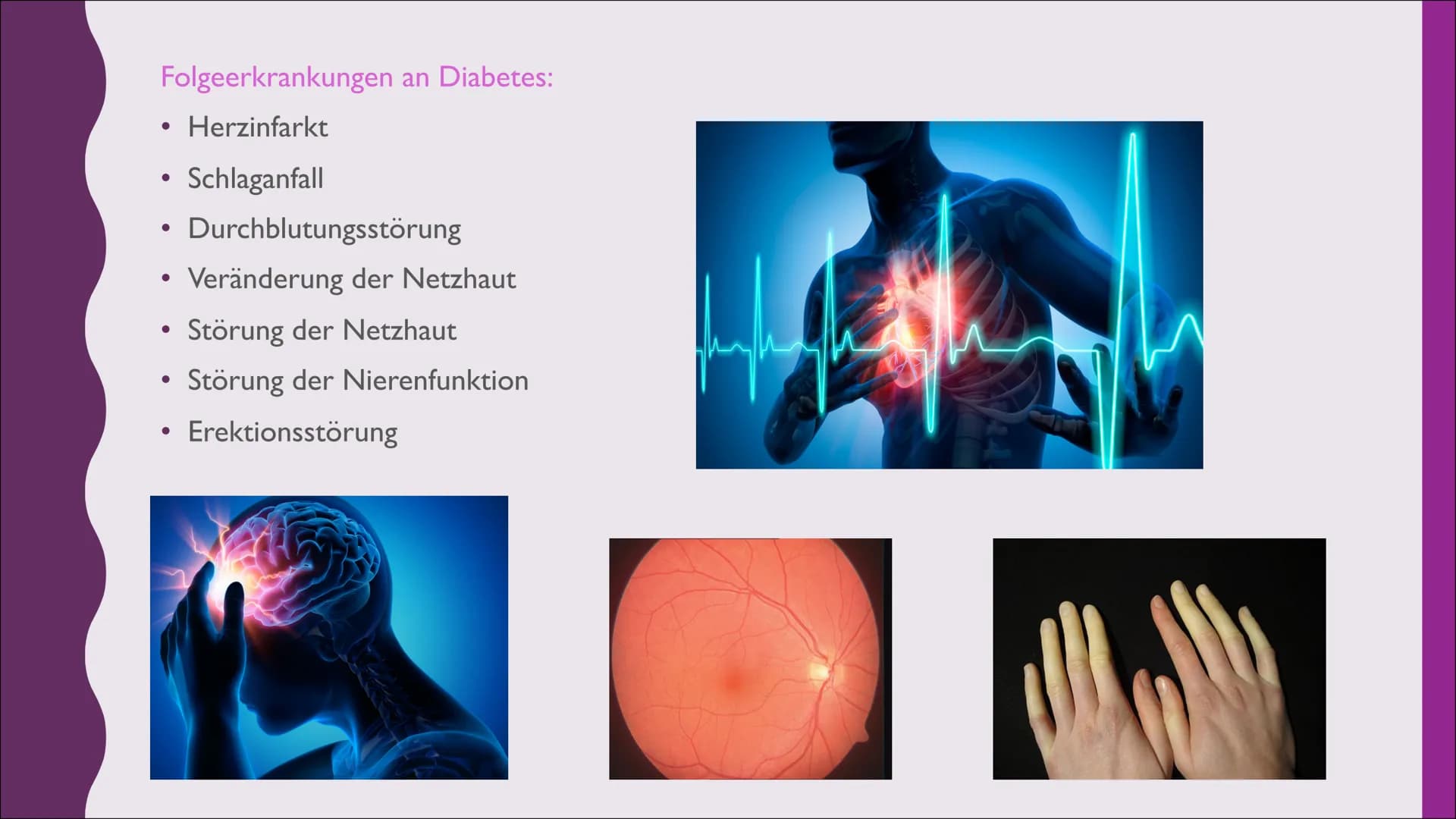 Diabetes # 1. WAS IST DIABETES:
• Diabetes ist eine Stoffwechselerkrankung, die neben dem Zuckerstoffwechsel vor allem den
Fettstoffwechsel