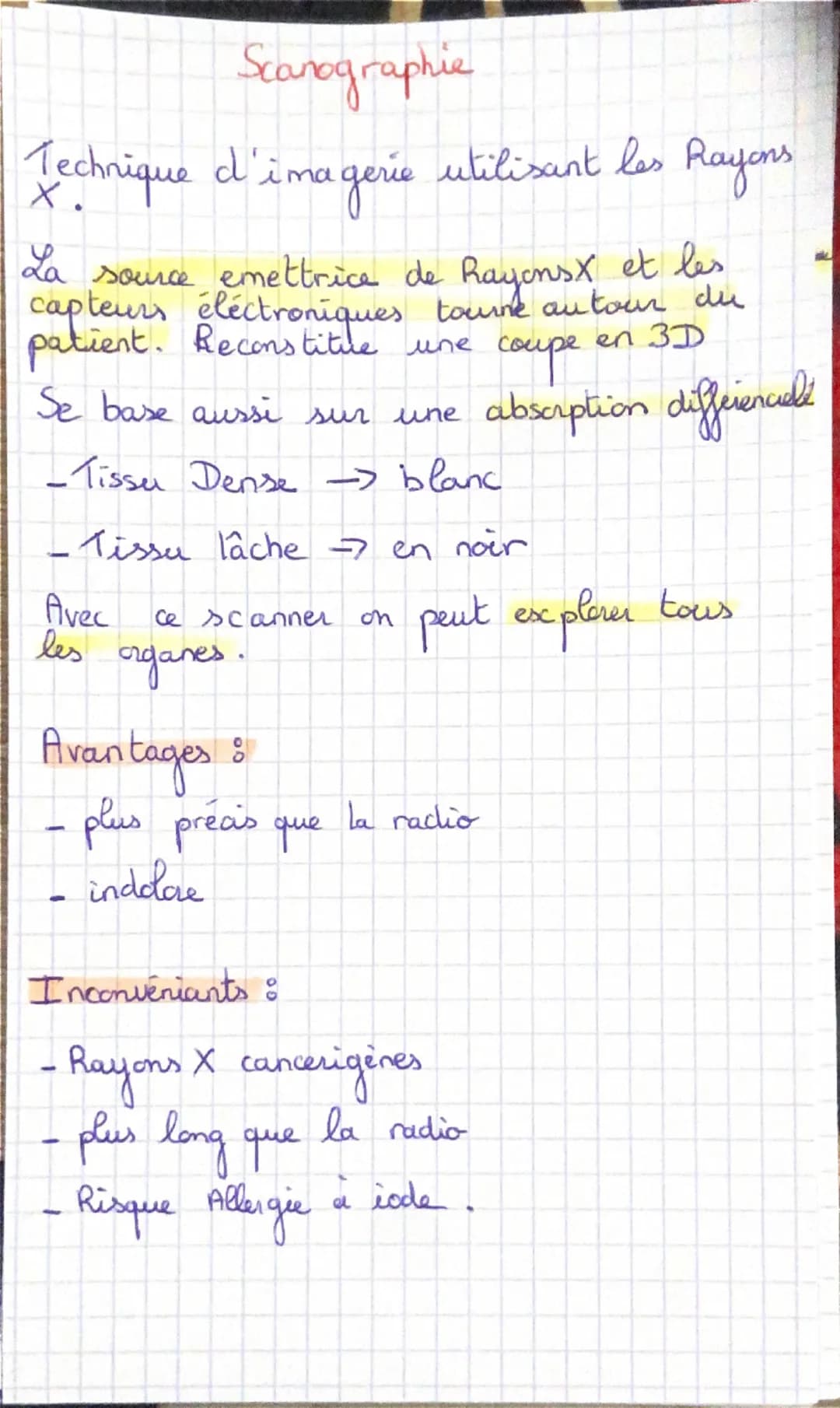 # Radiographie
Technique d'imagevé médicale utilisant
les Rayons X
Les Rayons X vont être absabés et ceux
qui ressortent frappent un recep