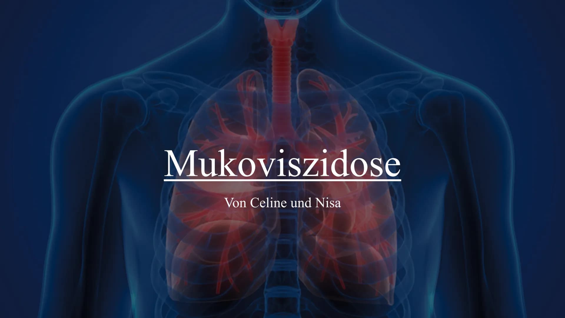 # Mukoviszidose
Von Celine und Nisa Gliederung:
◆Definition
◆Symptome
◆Ursachen
Krankheitsbild
◆Vererbung
◆Lebenserwartung/Vorkommen
◆Die